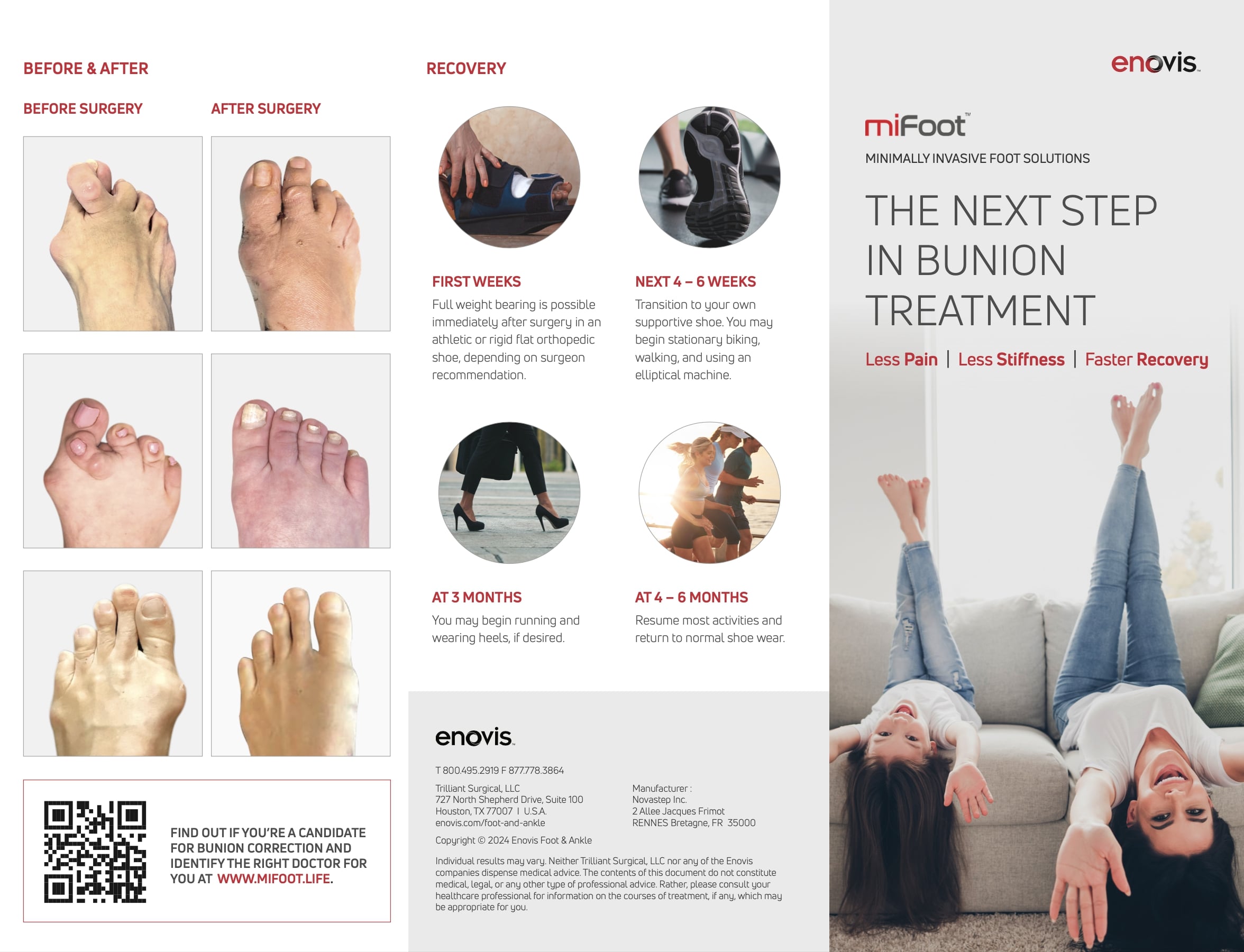 Mifoot Patient Brochure